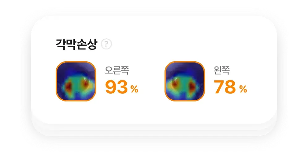 눈